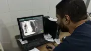 غياب أجهزة الرنين المغناطيسي في غزة.. أطباء بلا عيون ومرضى عالقون بين الحياة وحكم مؤجل بالموت