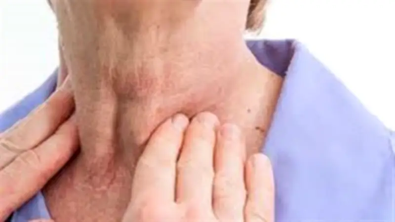 علامات تكشف الإصابة بسرطان الغدة الدرقية.. اذهب للطبيب فوراً