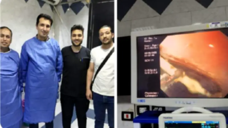 استخراج عصا مصاصة من قولون طفل من ذوي الهمم بالشرقية دون جراحة