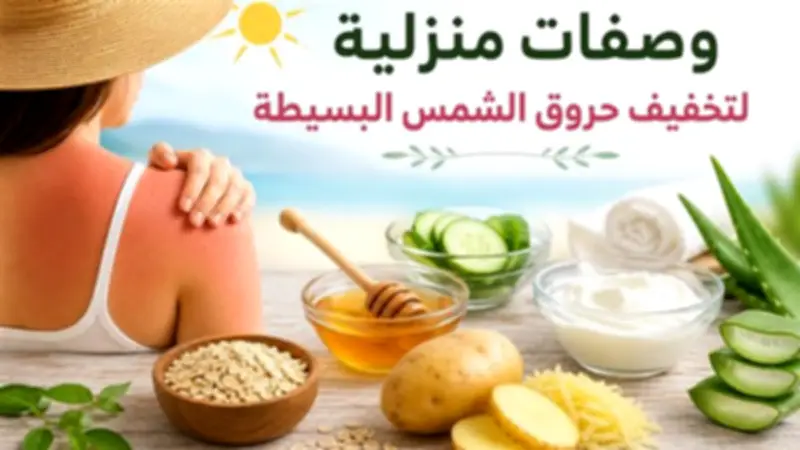 وصفات طبيعية منزلية لتخفيف حروق الشمس البسيطة في الصيف