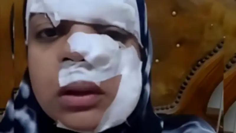 حبس زوج تشويه وجه زوجته بالموس لرفعها دعوى خلع بالغربية 4 أيام