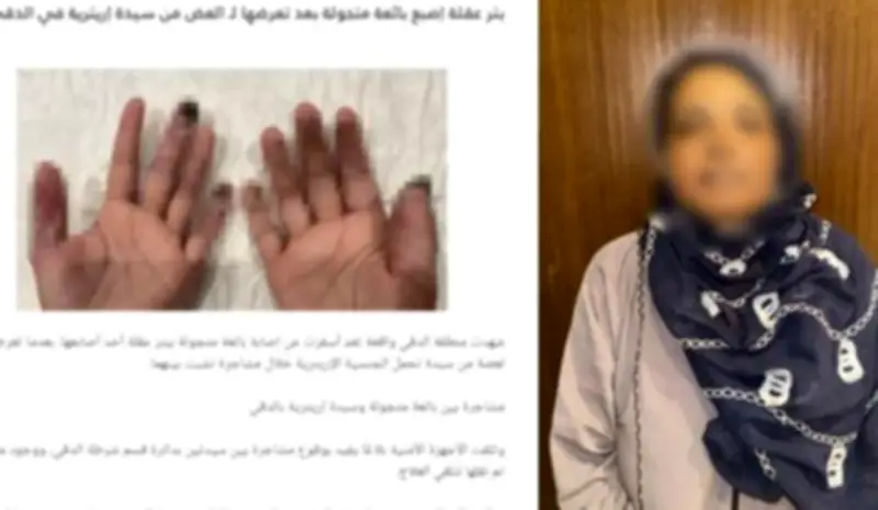 ضبط بائعة جائلة قطعت إصبع طفلة بسبب بكائها في القليوبية