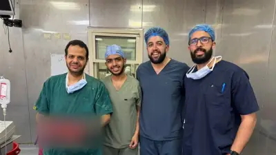 قصر العيني ينجح في استئصال ورم نادر بوزن 9 كجم من صدر مريض