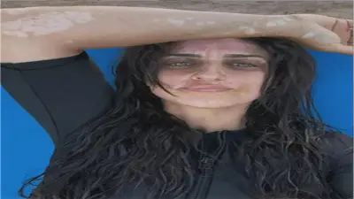 أمير كرارة يدعم شقيقته نسرين بعد إعلان إصابتها بالبهاق برسالة مؤثرة