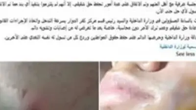 مشادة كلامية بسبب لهو الأطفال تؤدي لاعتداء بقطعة زجاج في البحيرة