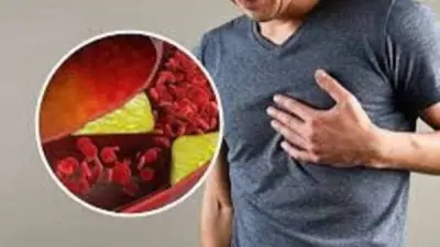 نبات الزعتر غير المتوقع يخفض ضغط الدم والكوليسترول