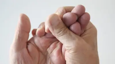 أعراض وأسباب التهاب المفاصل الروماتويدي: دليل شامل للمرض المناعي المزمن