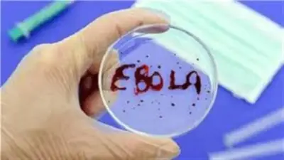 الكونغو الديمقراطية تفرض حجرا صحيا 21 يوما لمواجهة تفشي الإيبولا