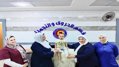 فريق طبي بمستشفى دسوق العام ينقذ طفلاً من حروق خطيرة بنسبة 20%