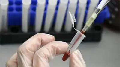 طفرة جينية دقيقة تحول فيروس كورونا إلى تهديد خطير للبشرية