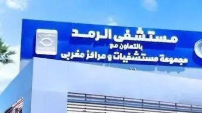 رمد بورسعيد ينقذ مريضين من فقدان البصر بعمليتين طارئتين للجلوكوما