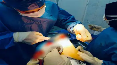 نجاح جراحة استئصال ورم دموي بالذراع لمريضة في مستشفى مشتول السوق