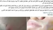 مشادة كلامية بسبب لهو الأطفال تؤدي لاعتداء بقطعة زجاج في البحيرة