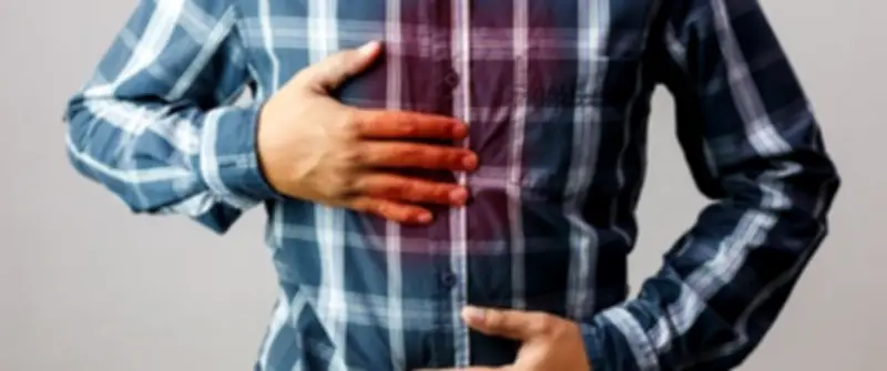 كيف تحمي معدتك من الحموضة وارتجاع المريء في الحر؟