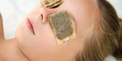 خطوات فعالة للتخلص من الهالات السوداء وانتفاخ العينين